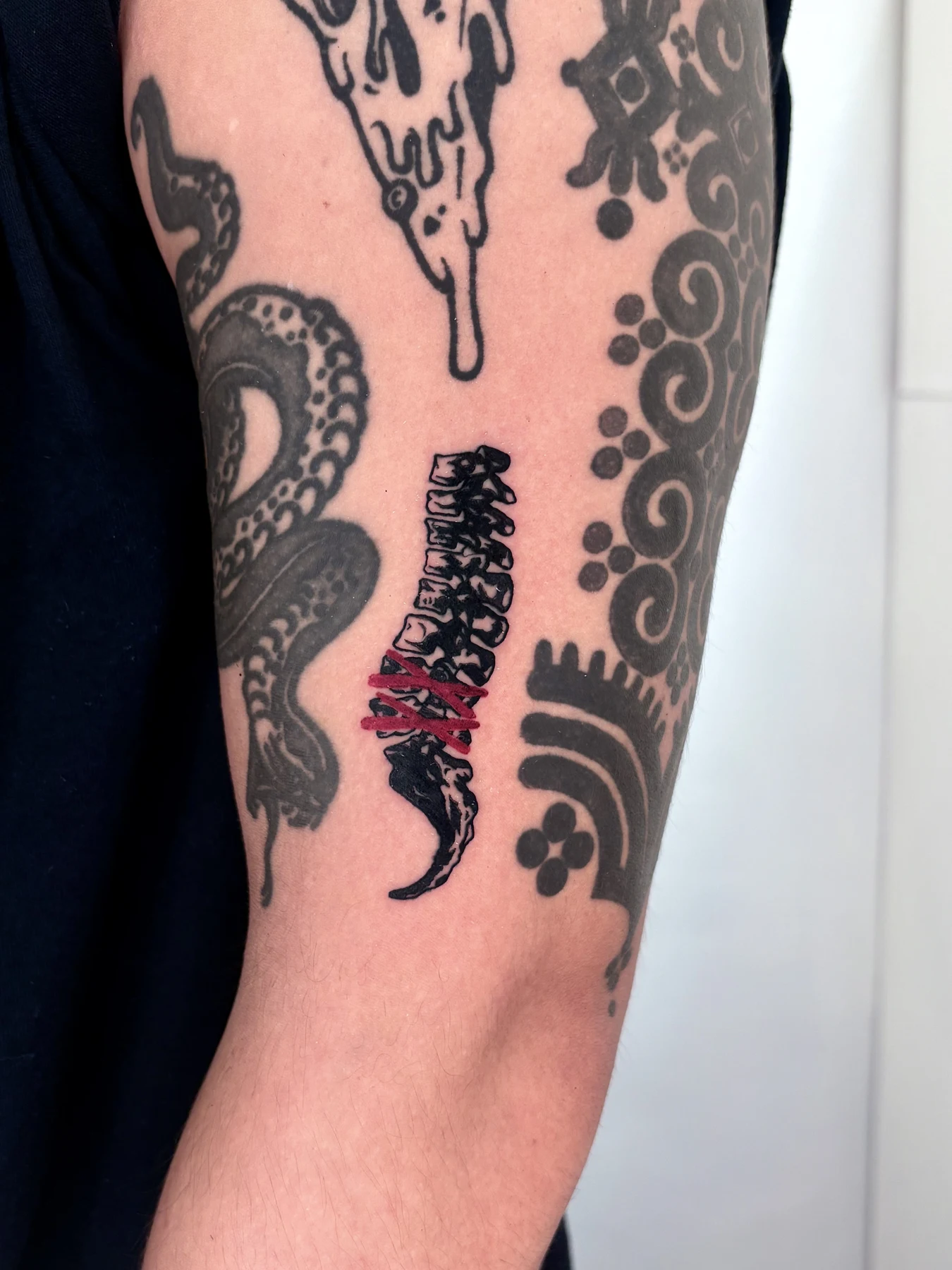 SPINE